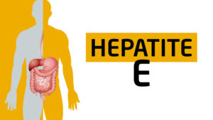 Hepatite e: o que é e principais sintomas