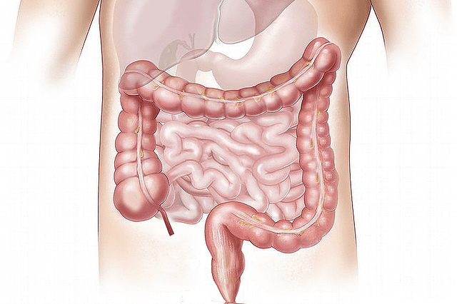 Colonoscopia: o que é e como é feito